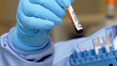 القومى للبحوث: اكتشاف مركب لعلاج أنواع السرطانات بمصر