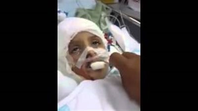 بالفيديو.. أحمد الدوابشة يلتقي نجوم ريـال مدريد.. متطرفون يهود أحرقوا عائلته خلال الصيف الماضي.. 6 أشهر للعلاج في مستشفى إسرائيلي.. ولقاء نجوم «الملكي» يحقق حلم الطفل الصغير