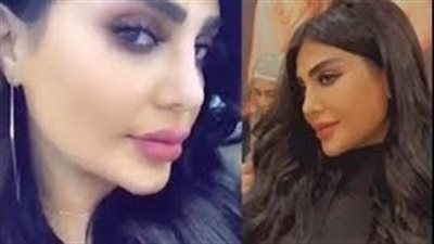 فنانة خليجية تخضع لعملية تجميل لتطويل أنفها (فيديو)