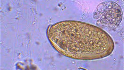إجراءات وزارة الصحة لمكافحة دودة «الفاشيولا» المسببة لأمراض الكبد