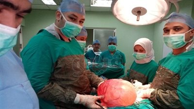 استئصال ورم من رحم سيدة بمستشفى التأمين الصحي ببني سويف (صور)