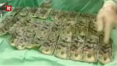 بالفيديو.. سيدة تبتلع 7 آلاف دولار لإخفائها عن زوجها