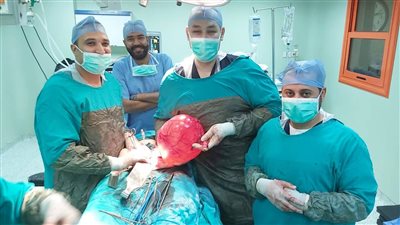 محافظ بني سويف يشيد بأطباء التأمين الصحي لاستئصالهم ورما ضخما من رحم سيدة