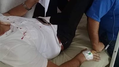 الاعتداء على طبيب أطفال بمستشفى التل الكبير في الإسماعيلية