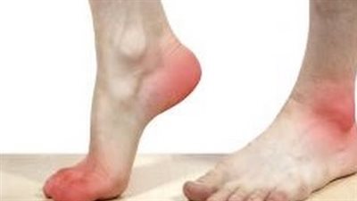 وصفة طبيعية تخلصك من آلام القدم والكعبين