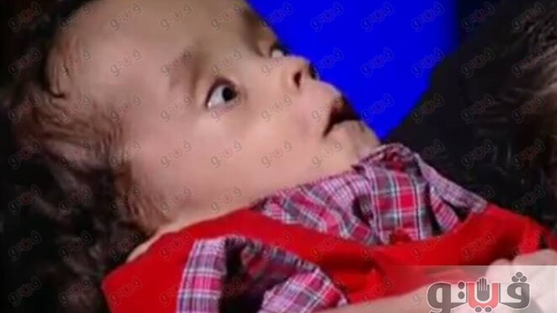 الطفل محمود حازم