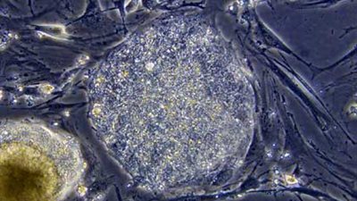 علماء يزرعون فى المخ خلايا جذعية مستمدة من جلد الفئران