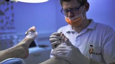 استشارى: الليزر أفضل علاج لالتئام جروح القدم السكرى بعد الغرغرينة