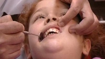 5 أطعمة تمنع تسوس الأسنان وتقتل البكتيريا