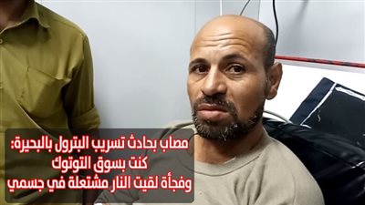 مصاب بحادث تسريب البترول بالبحيرة: كنت بسوق التوك توك وفجأة لقيت النار مشتعلة في جسمي