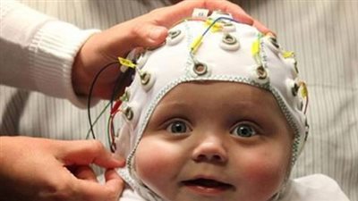 تشخيص «التوحد» عند الرضع بواسطة أشعة المخ الكهربائية