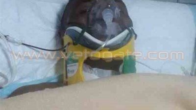 ننشر أول صورة للاعب «ليوبارد» في العناية المركزة