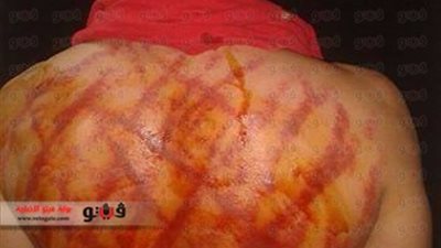 بالصور.. واقعة تعذيب جديدة لأمين شرطة داخل قسم أول شبرا الخيمة