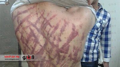 بالصور.. واقعة تعذيب جديدة لأمين شرطة داخل قسم أول شبرا الخيمة..«المتحدث بنادي القاهرة» يستنكر الواقعة ويطالب وزير الداخلية بالتحقيق..الشهاوى: اتخاذ الإجراءات القانونية ضد الضباط
