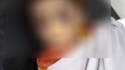 أمن الشرقية يكثف جهوده لكشف هوية طفلة عُثر عليها وبها آثار تعذيب