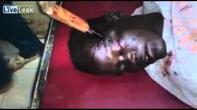 بالفيديو.. سكين تستقر برأس رجل ويظل على قيد الحياة