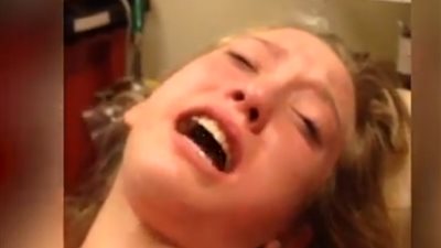 شاهد ماذا فعلت فتاة تحت تأثير مخدر خلع الأسنان (فيديو)
