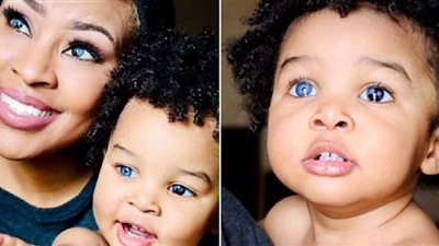 ظاهرة فريدة من نوعها.. أم وابنها بعينين زرقاء وسوداء في القزحية الواحدة| صور