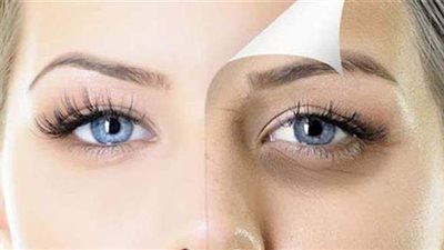 أبرزها الطماطم والليمون.. وصفات طبيعية للتخلص من الهالات السوداء بشكل نهائي