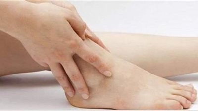 أعراض جلطة الساق ونصائح للوقاية منها