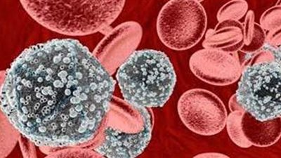 الإيدز.. الأسباب والأعراض وطرق الوقاية