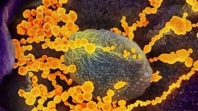 منظمة الصحة العالمية تحذر من اعتماد جوازات سفر كورونا