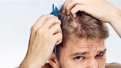 علاج تساقط الشعر للرجال