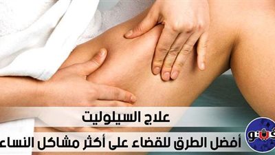 علاج السيلوليت.. أفضل الطرق للقضاء على أكثر مشاكل النساء | فيديو