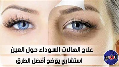 علاج الهالات السوداء حول العين.. استشاري يوضح أفضل الطرق | فيديو