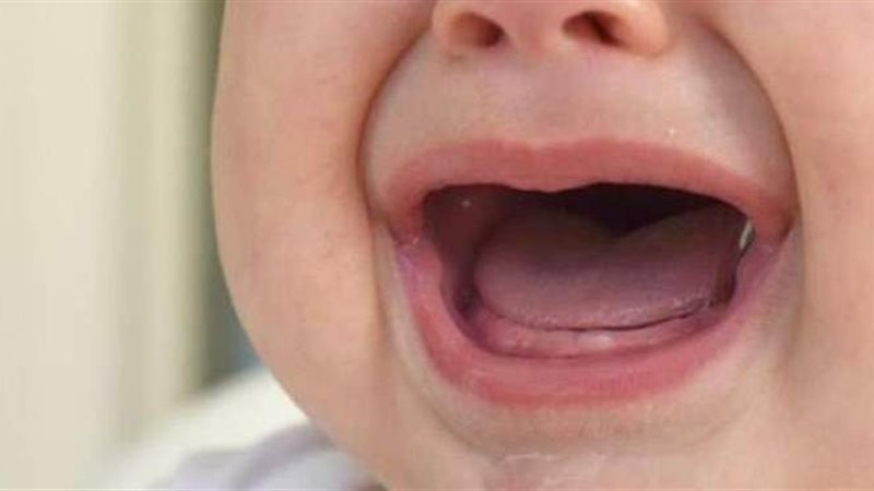 أعراض التسنين عند