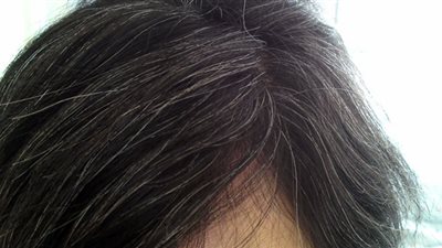 ثلاثية تأخير ظهور الشعر الأبيض