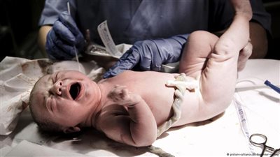 «القفازات الطبية» لحماية المواليد من العدوى