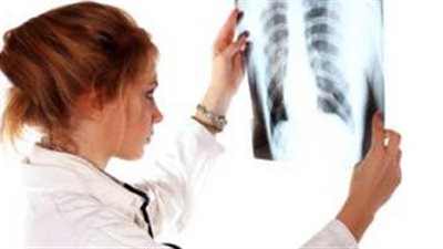 أستاذ أورام: سرطان غشاء الرئة البلورى ليس له علاج