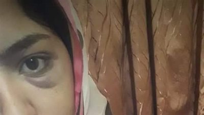 طالبة تروي تفاصيل الاعتداء عليها بجامعة حلوان للاعتراض على معاكستها