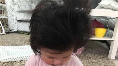 شعر طفلة يثير حيرة كل من يشاهدها (صور)