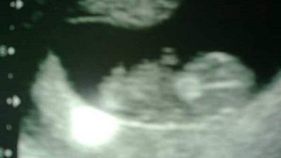 جنين يرتدي سماعات الرأس برحم والدته (صور)