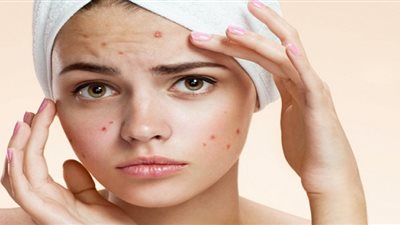 للحوامل.. 5 طرق للتعامل مع حب الشباب