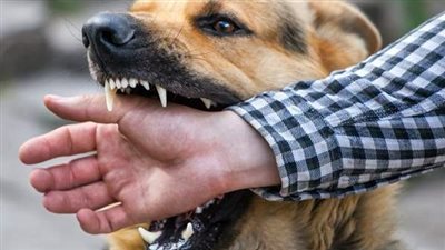 الاستماع لأقوال والد طفل عقره كلب في ذراعه ببولاق