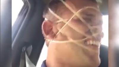 شاب يقع في مأزق بربطه وجهه بـ«الأساتك المطاطة» (فيديو)