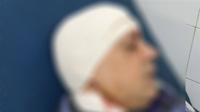 في محاولة لسرقته.. إطلاق النار على 