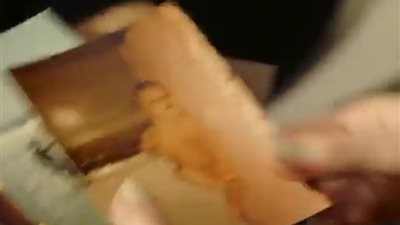 امرأة تكتشف سر لوني بشرتها المختلفين (فيديو)