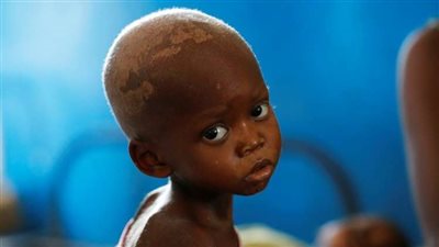 وفاة مئات الأشخاص في الكونغو لأسباب غامضة