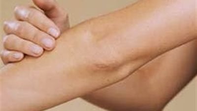 3 وصفات للقضاء على اسمرار «الركب والكوعين»