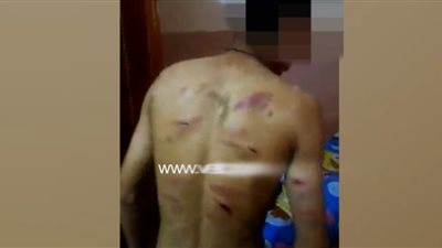 «تضامن الدقهلية»: استبعاد مشرف دار تعذيب الأيتام والتحقيق مع المدير