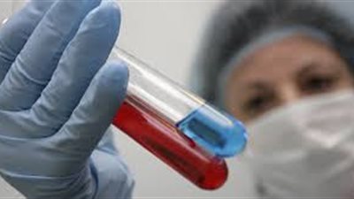 أستاذ مناعة يكشف مفاجأة عن المصابين الجدد بالإيدز في مصر