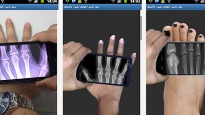 صور إجراء جسدك بالأشعة السينية من خلال هاتفك الذكي