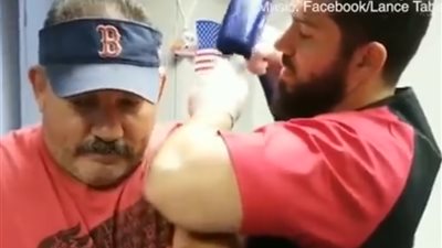 طبيب يعيد ذراع رجل للحركة بعد 10 سنوات باستخدام مطرقة (فيديو)