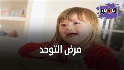 مرض التوحد | ٣ مراحل أساسية للتعامل مع حالات التوحد