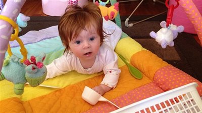 بالصور.. «ديلى ميل» تنشر صور الأطفال ذو الشعر الكثيف حول العالم