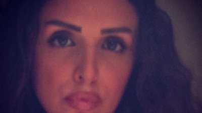 صورة صادمة للمطربة أنغام